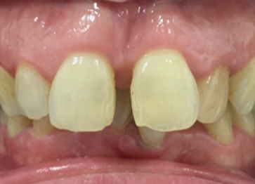 Before - Partington Dental