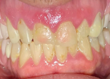 Before - Partington Dental